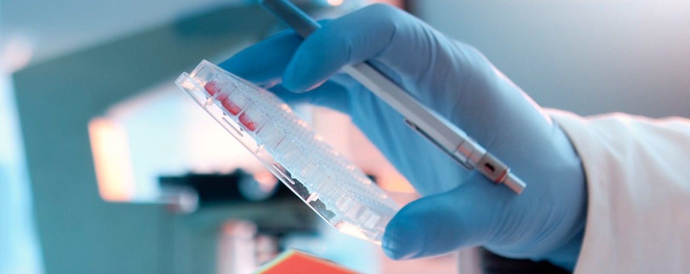 Immune & Profile Tests