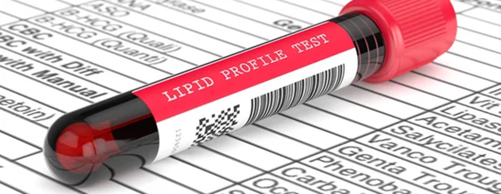 Lipid & Glucose Profile